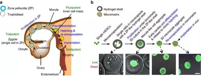 心肌梗死干细胞治疗,自身骨髓干细胞移植治疗心肌梗死