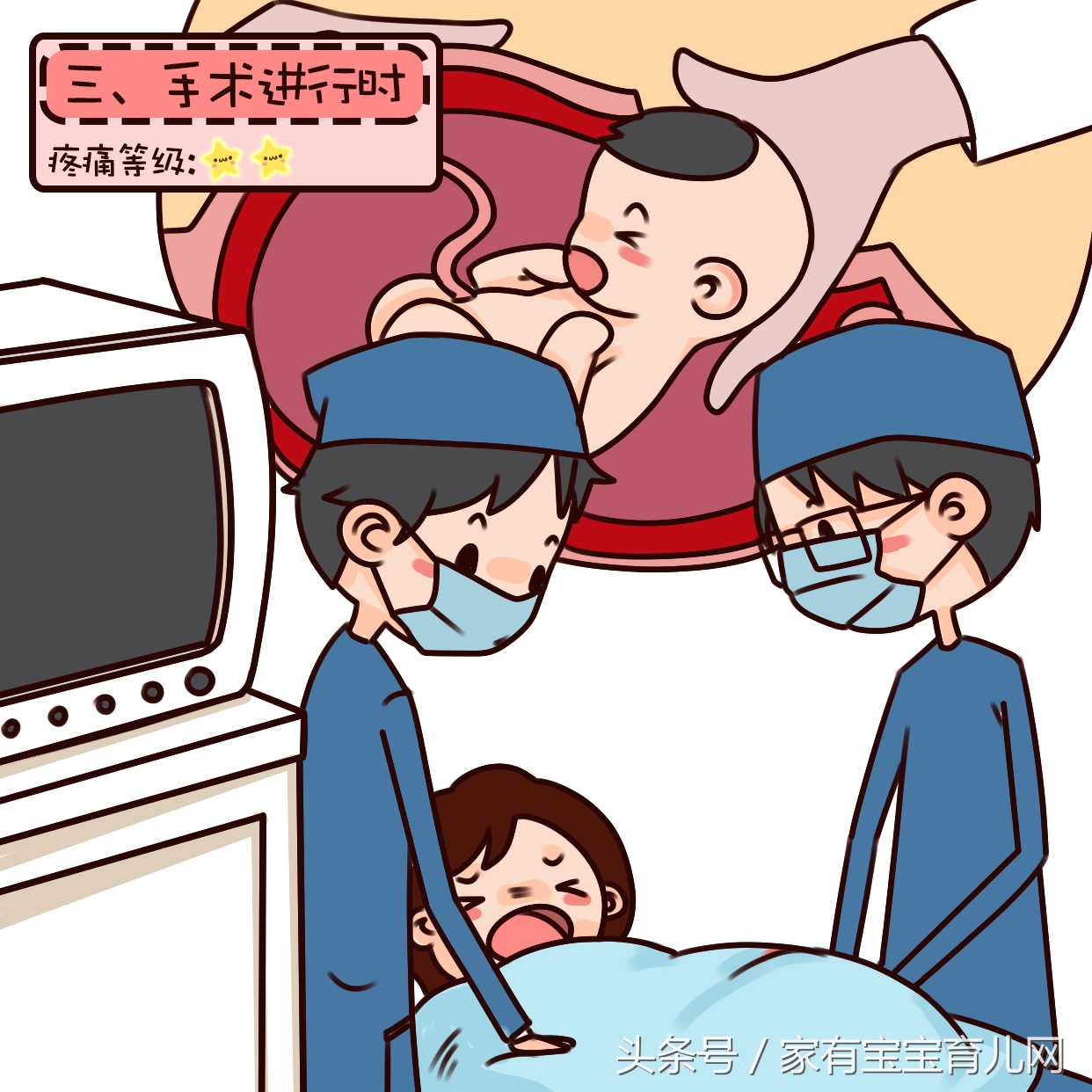 谁说剖腹产不痛了?剖腹产全过程疼痛等级大比拼,最后一步才最痛