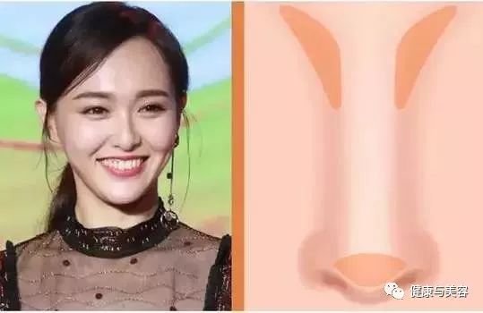 杨幂、唐嫣、神仙姐姐的鼻子原来是这样“整的”！