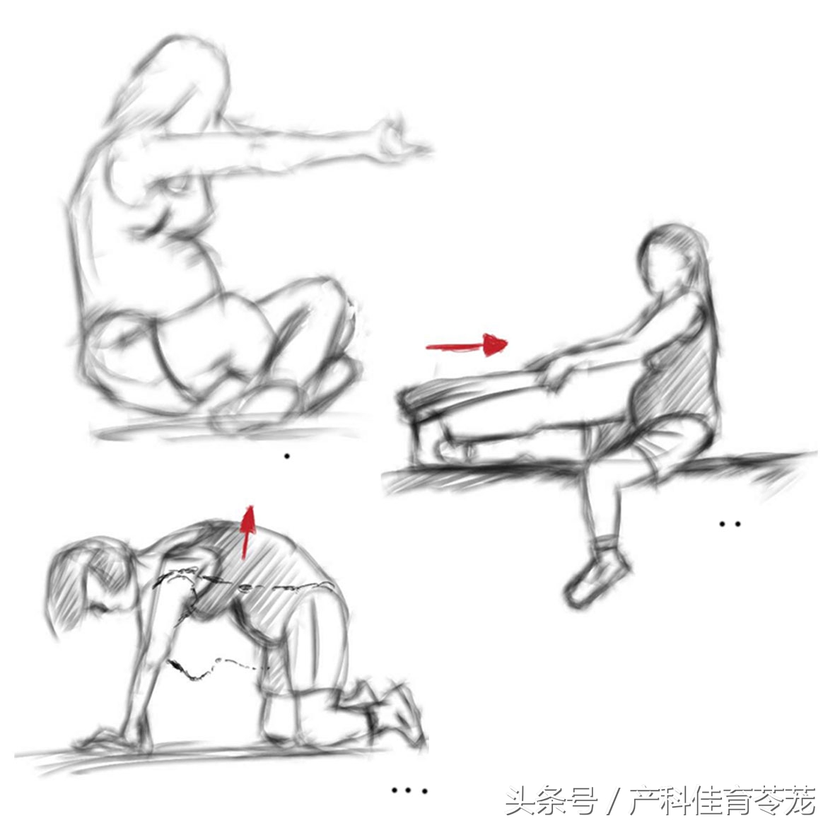 给您支几招，避免不必要的会阴侧切