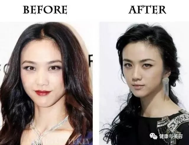 杨幂、唐嫣、神仙姐姐的鼻子原来是这样“整的”！