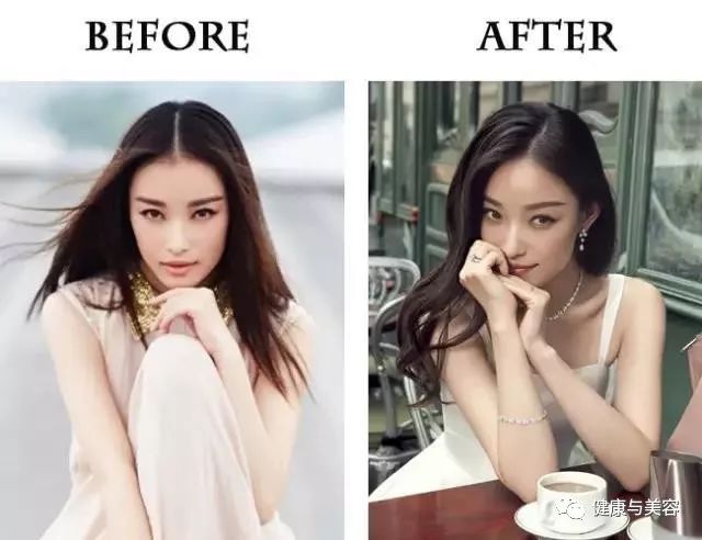 杨幂、唐嫣、神仙姐姐的鼻子原来是这样“整的”！