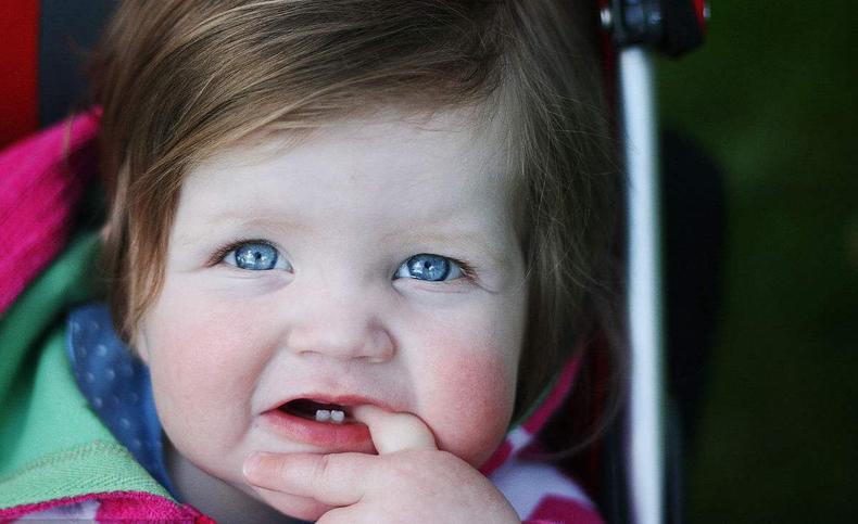 冬天宝宝护脸小妙招,宝宝冬季脸怎么护理