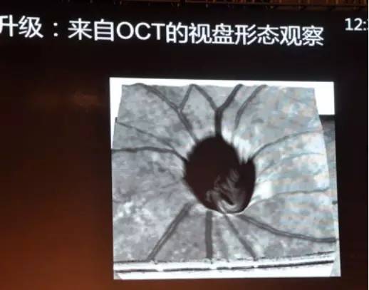 COFDS2016EthanPriel教授：多模式成像在神经眼科中的应用