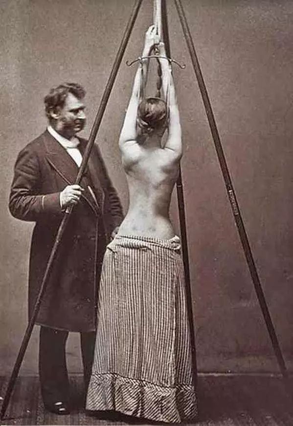 看着吓人的治疗方法,最让人毛骨悚然的疾病