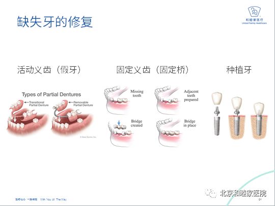 婴儿口腔健康教学,少儿口腔健康课堂