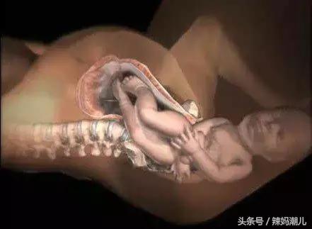 顺产是撕心裂肺的疼？高清图揭示分娩的真相！