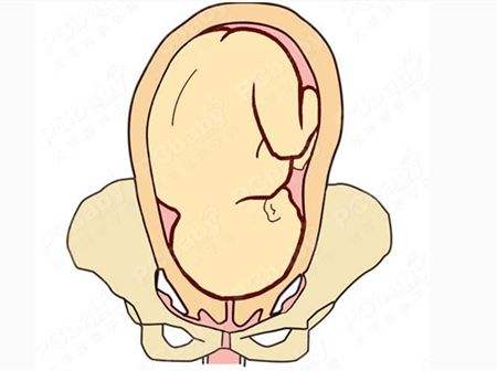 让准妈妈们闻风丧胆的“侧切”，只有遇到下面几种情况才需要进行