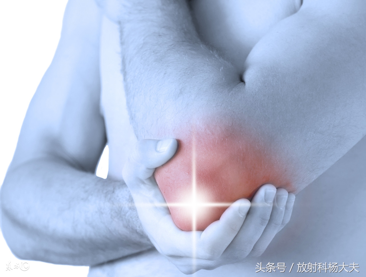 和骨肉瘤相似的病,骨肉瘤罕见病