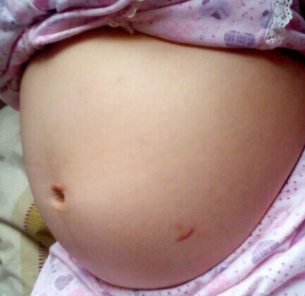 一胎保胎心路历程,揭秘我的艰难怀孕之路