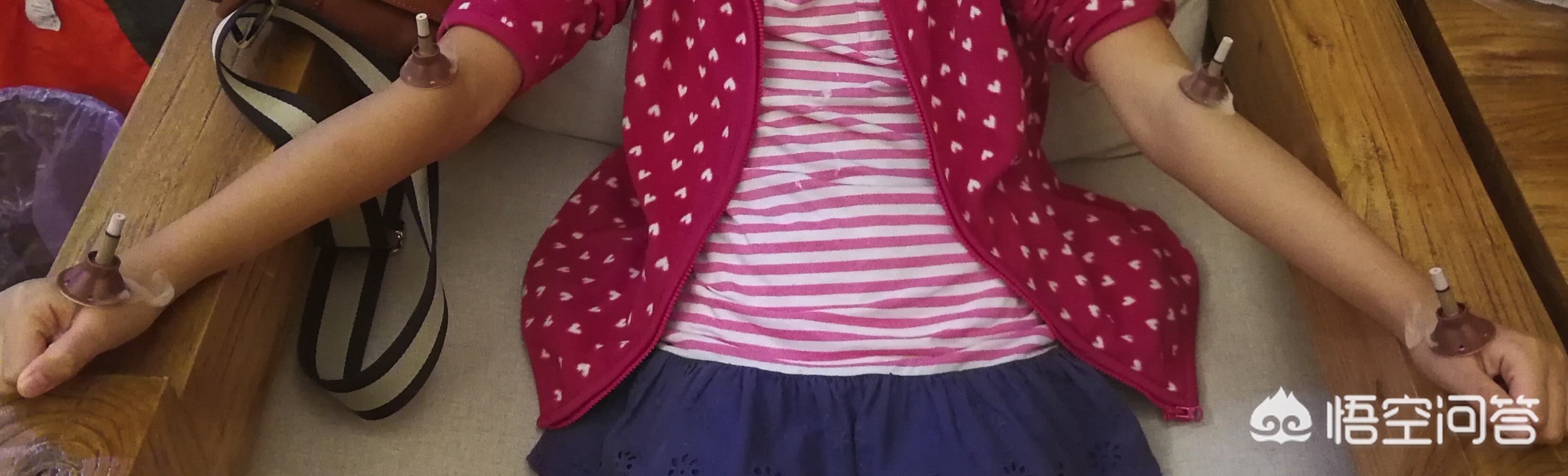 小孩子耳聋怎么办,儿童一般用什么药会致聋