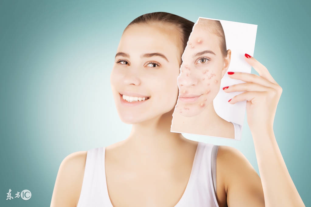 青少年*疮痤**的治疗方法都有什么