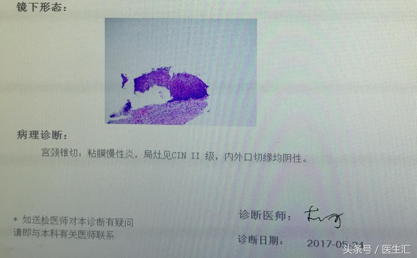 子宫腺肌症中医病历,子宫腺肌病疑难病例分析报告