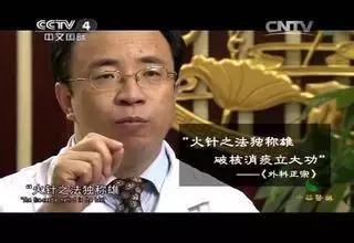 北京治疗肿瘤的中医专家黄金昶,黄金昶主任治疗肿瘤怎么样