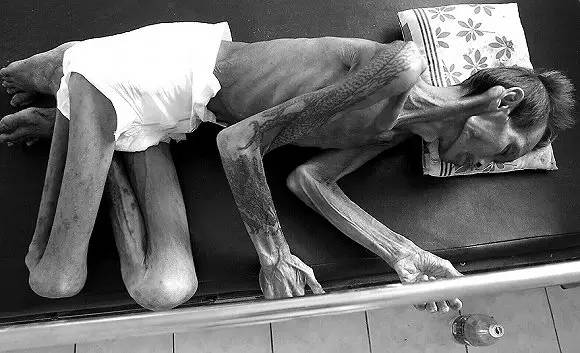 用套套挽救770万人生命!这个75岁泰国老头做到了!