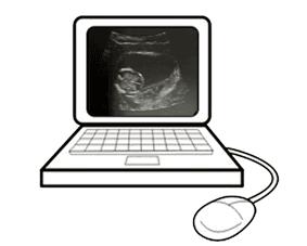 第一次产检都问什么,产检一路绿灯过来人的经验