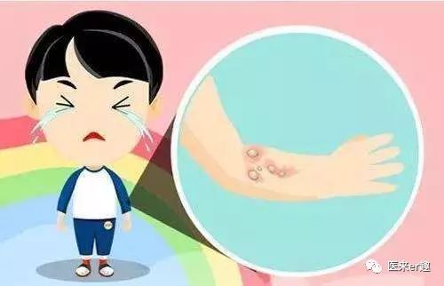 最全外伤科普集锦,谁不受伤谁的过往不曾有遗憾