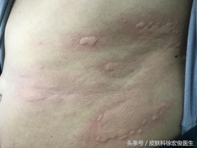 7种常见皮肤科用药便宜又好用,皮肤科常用好用实用的药品