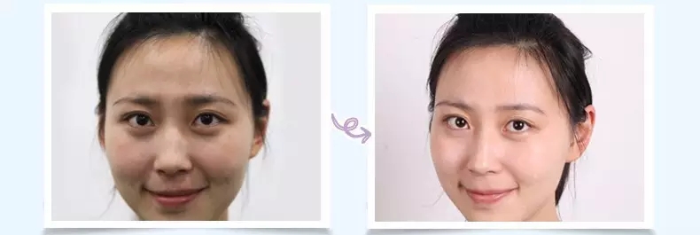 兰芝隔离测评适合干皮,兰芝紫隔离好用吗