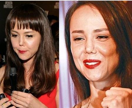 香港最老明星整容失败照片对比,整容失败的明星有哪些