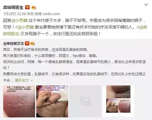 扎“火针”治宫颈糜烂？从先秦流传下来的火针疗法究竟是啥？