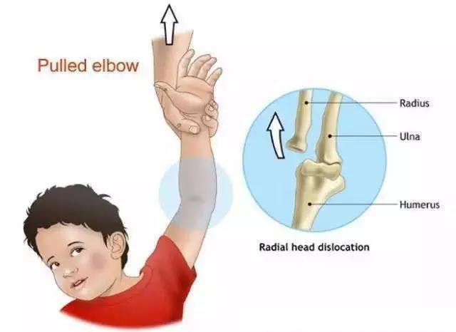 家长应教会孩子自救方法有哪些,家长必懂的急救方法