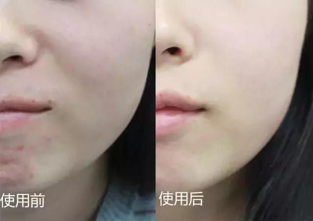 濞滄墡寮犵堪鍒嗘墜鏄湡鏄亣,濞滄墡寮犵堪鍒嗘墜浜嗗悧