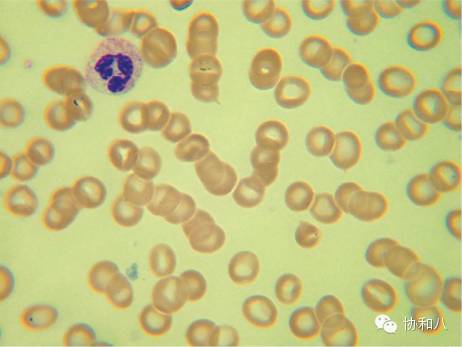 是COOMBS，不是Combs|一页手册·协和八