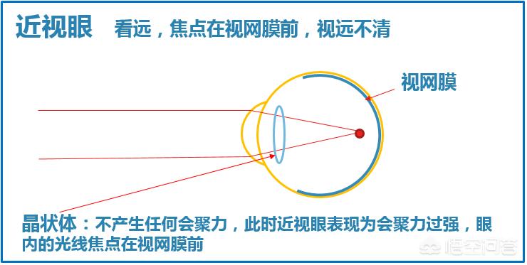 晚上如何远眺防近视,为什么远眺有助于预防近视