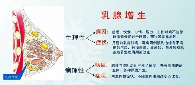 乳腺增生囊肿为啥不需要特殊治疗,乳腺增生囊肿医院做十天的治疗