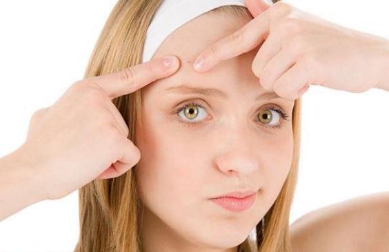 科学祛痘去印,科学祛痘印方法