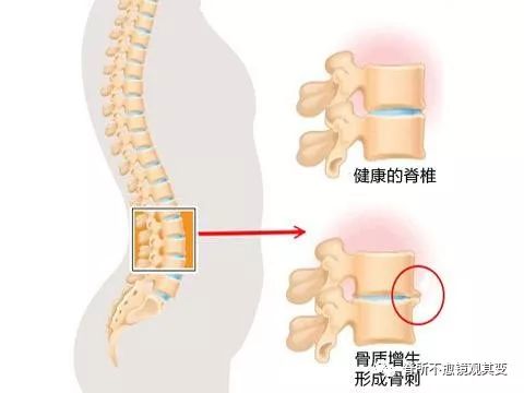 痛与疼的区别解释,痛和不舒服什么区别