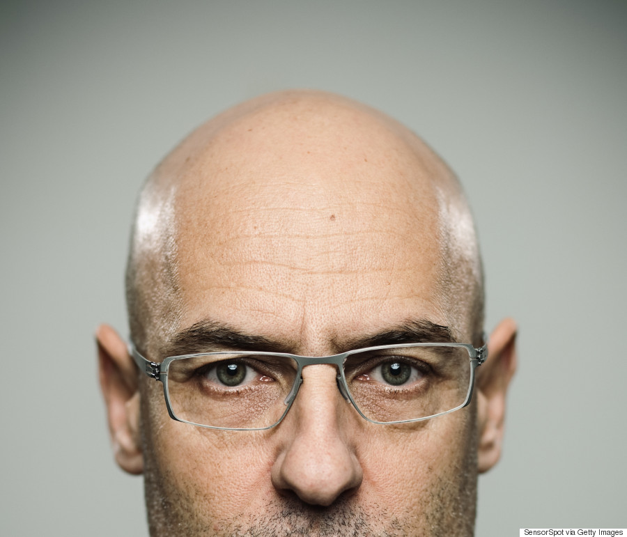 目前最先进的毛囊再生技术,秃头快速生发