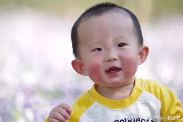 宝宝秋冬季红脸蛋的原因,宝宝秋冬红脸蛋怎么回事