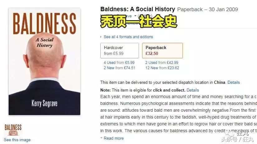 日本研究秃顶,日本教授秃头研究