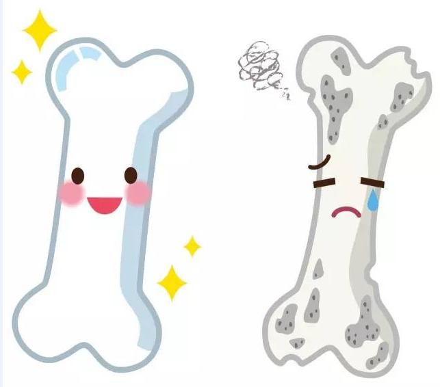 光靠补钙就能预防骨质疏松吗,中年妇女预防骨质疏松吃什么钙片