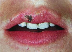 流感好了感觉不快乐,流感好了不想吃饭