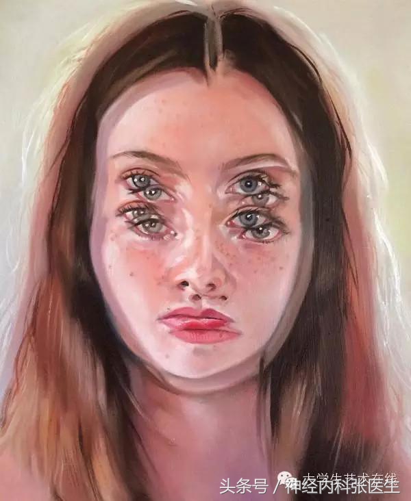 眩晕是怎么引起的病根在哪里,导致眩晕的罪魁祸首有哪些