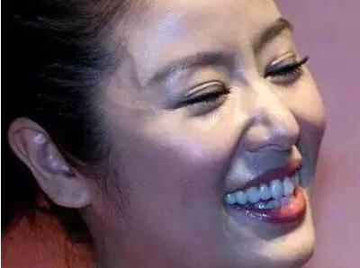 女明星都用双眼皮贴,为什么女明星用双眼皮贴