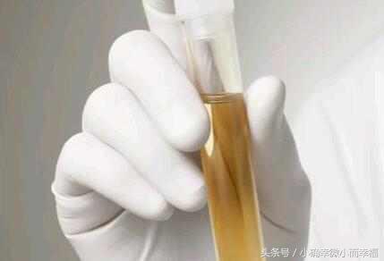 老鼠爬过的菜还可以吃吗,老鼠爬过的菜有毒吗