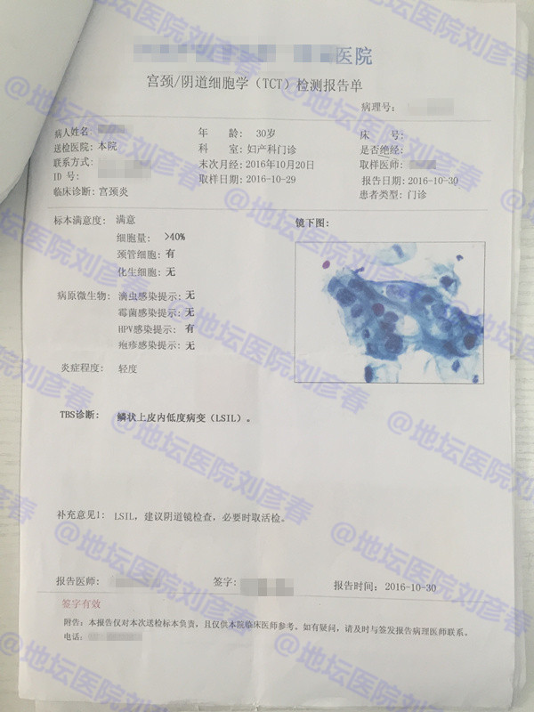 hpv感染分享治愈全过程,感染hpv发作过程的真实案例