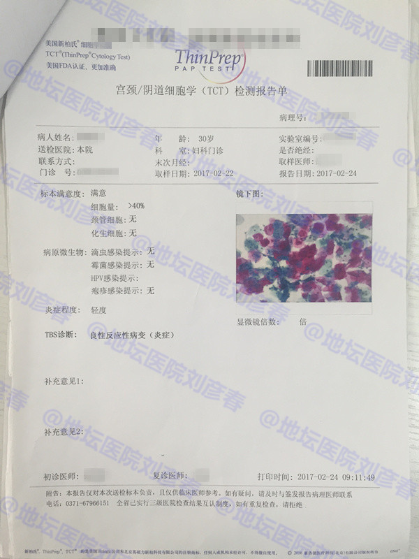 hpv感染分享治愈全过程,感染hpv发作过程的真实案例