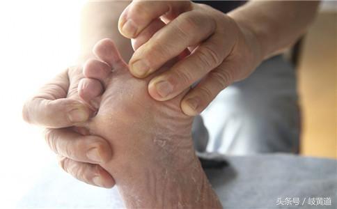 一脱鞋臭气熏天,一脱鞋就臭