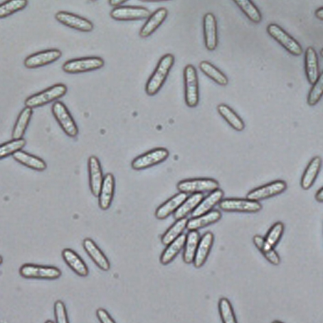 辣椒炭疽病的病原形态,辣椒炭疽病的病症为点状物