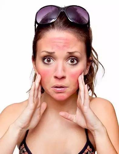 日本妹子美白小妙招,敏感肌怎么在强烈的暴晒后修复