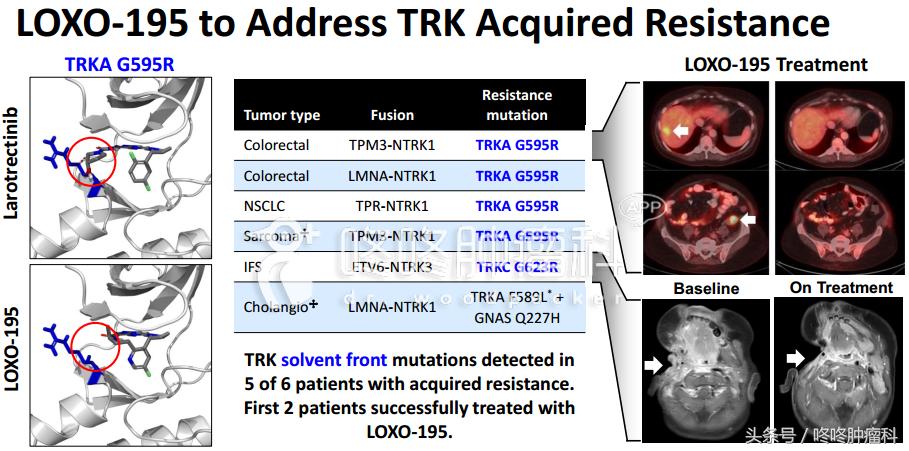 larotrectinib是靶向药吗,larotrectinib的靶向药