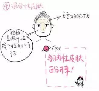 为什么最近皮肤比较油,导致皮肤油的原因你了解吗