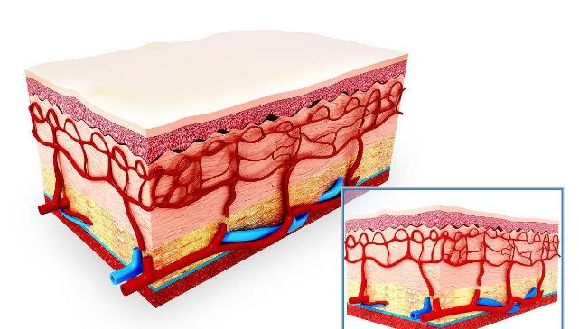 如何轻松解决疣体,一招教你如何祛除扁平疣