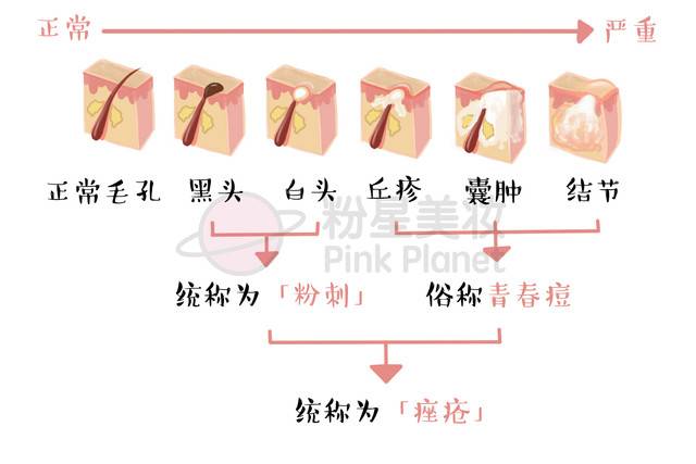 长痘痘怎么才能不留印,长痘痘了怎么消除不留疤