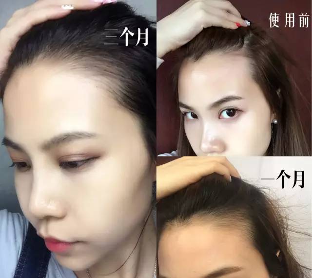 春天来了发型讲解,春天护发知识大全